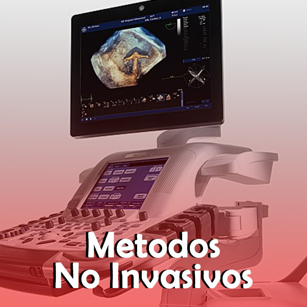 Metodos Diagnosticos No invasivos